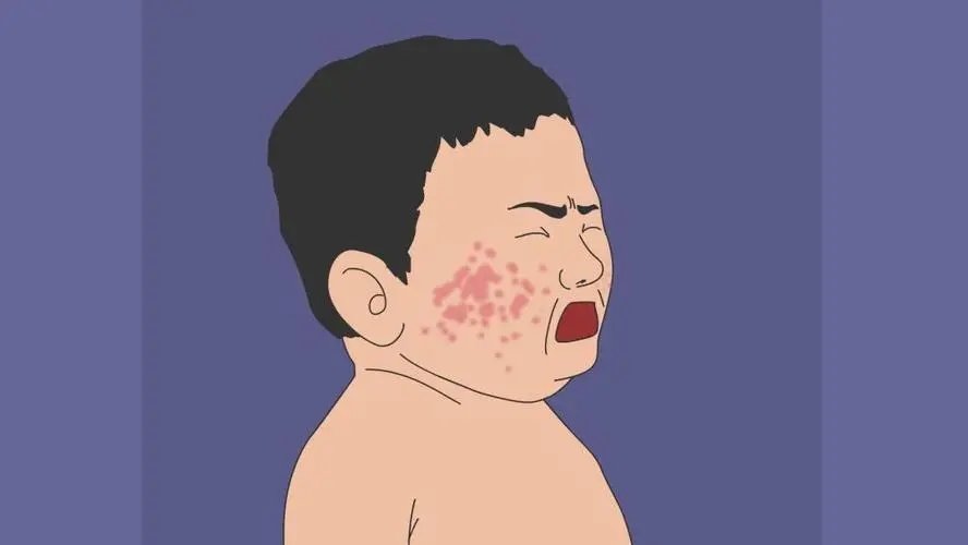 脸颊发红是过敏性皮炎吗以及如何预防比较好?